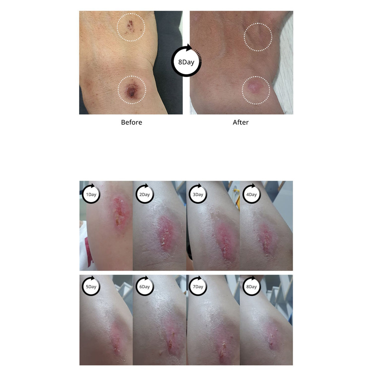 [ La Chomb ] LA BLANCHE Cream 60ml - Beautiha