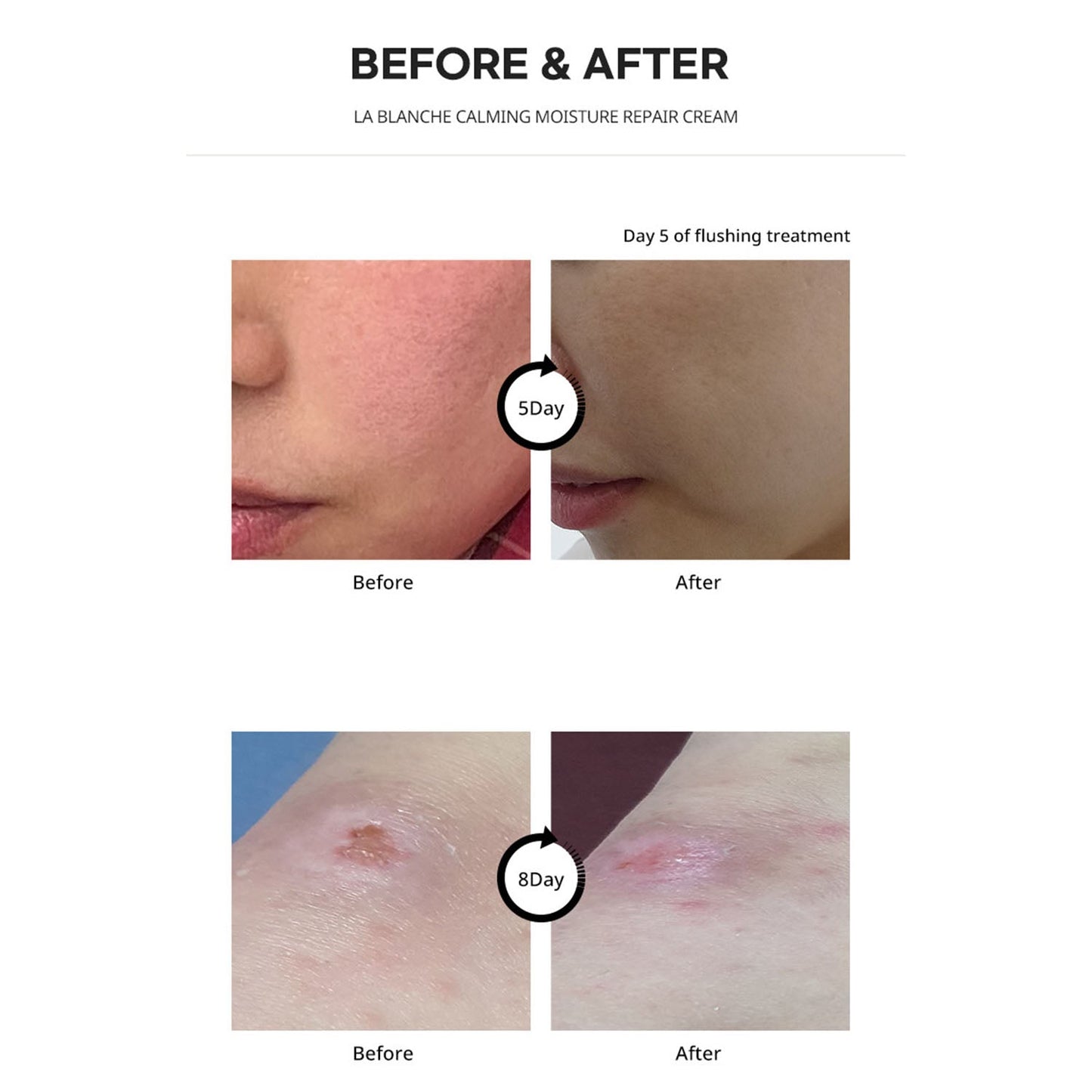 [ La Chomb ] LA BLANCHE Cream 60ml - Beautiha