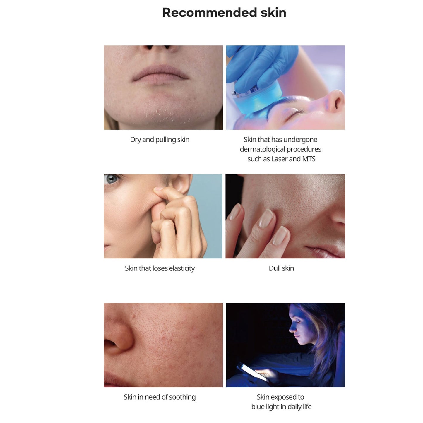 LAFIN COMPLETE RENEW CREAM 35g - Beautiha